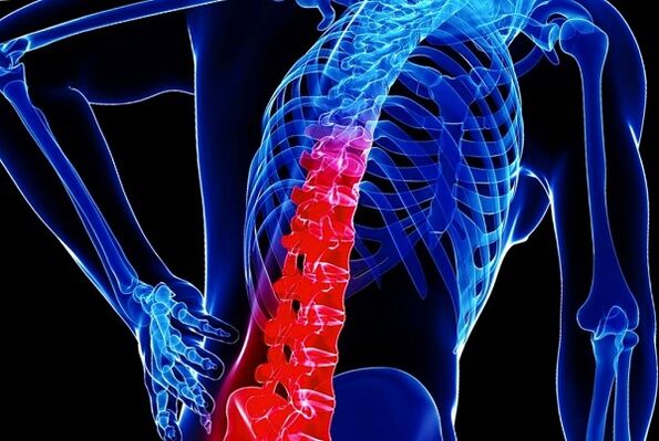 Les raisons du développement de l'ostéochondose thoracique
